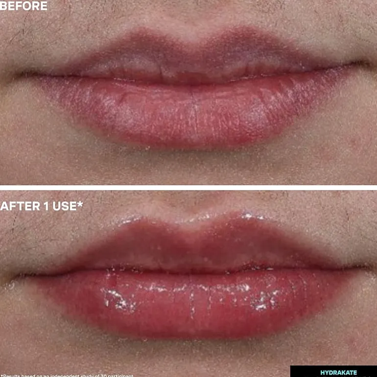 Kate Somerville Hydrakate® Pro-Collagen Lip Oil Elixir
