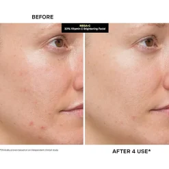 Kate Somerville Mega-C® 30% Vitamin C Brightening Facial