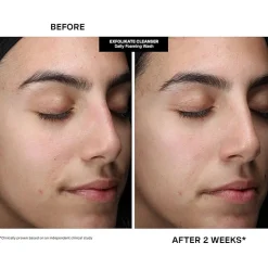 Kate Somerville Pore-Fect Skin Edit ($51 Value)