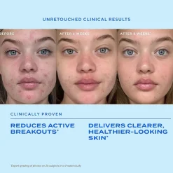 Murad Biome-Balancing Clear & Prevent Acne Treatment Serum