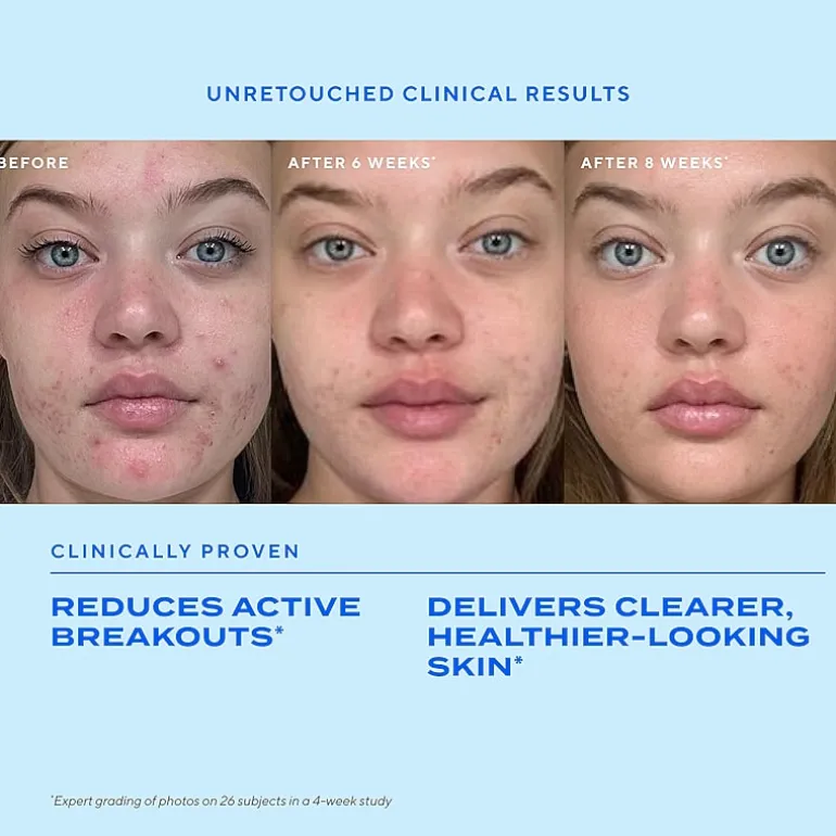 Murad Biome-Balancing Clear & Prevent Acne Treatment Serum