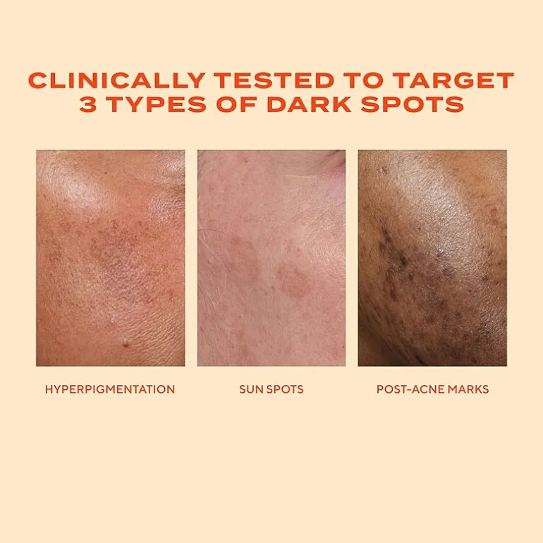 Murad Rapid Dark Spot Correcting Serum Face Serum