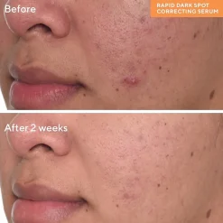Murad Rapid Dark Spot Correcting Serum Face Serum