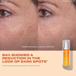 Murad Rapid Dark Spot Correcting Serum Face Serum