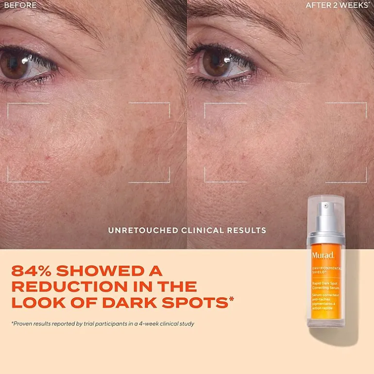 Murad Rapid Dark Spot Correcting Serum Face Serum