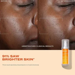 Murad Rapid Dark Spot Correcting Serum Face Serum