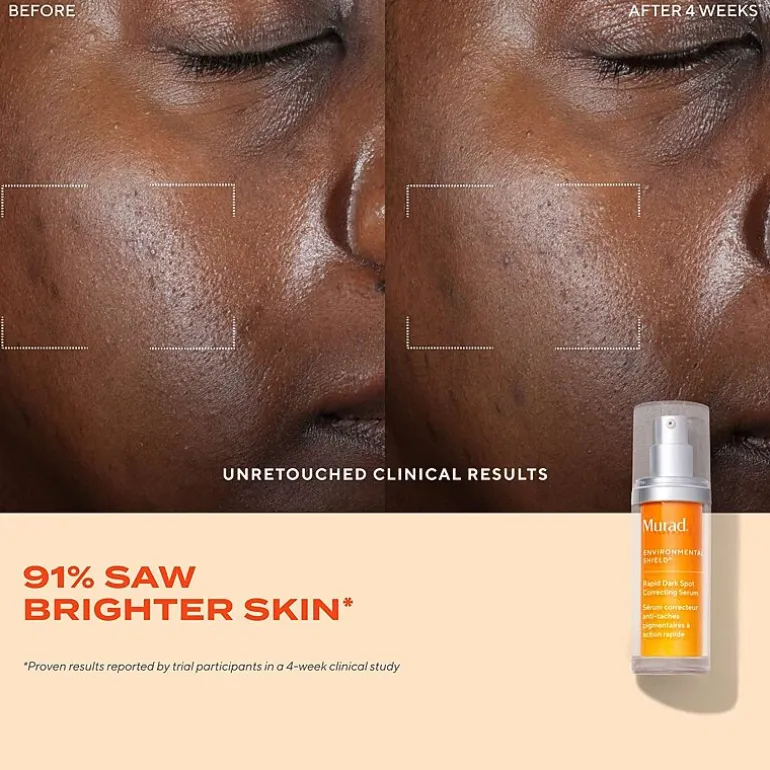Murad Rapid Dark Spot Correcting Serum Face Serum