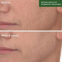 Murad Retinal Resculpting Overnight Treatment Facial Treatment
