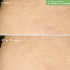 Murad Retinol Youth Renewal Face Serum
