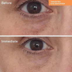 Murad Targeted Eye Depuffer