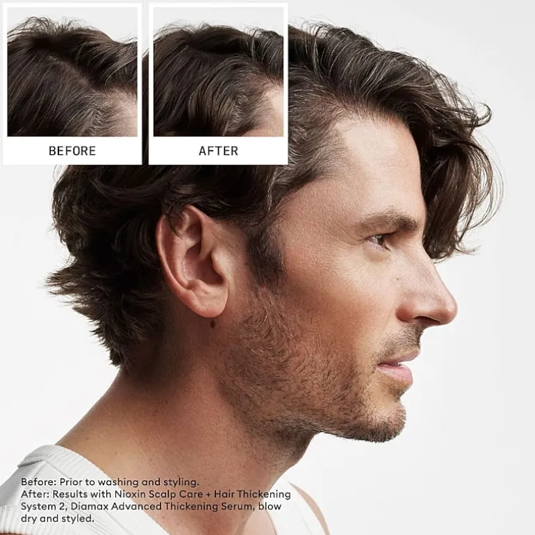 Nioxin® System 2 Scalp Care + Hair Conditioner 33.8 oz.