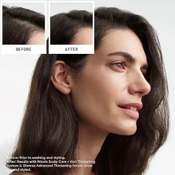 Nioxin® System 3 Scalp + Hair Shampoo 33.8 oz.