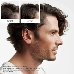 Nioxin® System 2 Scalp + Hair Shampoo 33.8 oz.