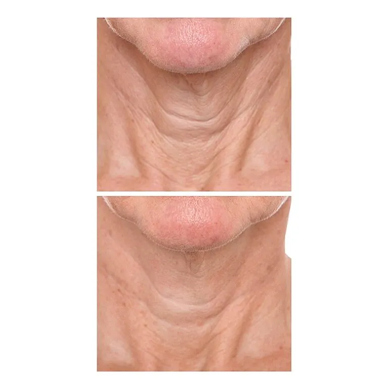 PRAI Beauty Ageless Throat & Decolletage Creme