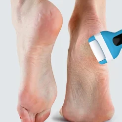 Prospera Electric Foot Callus Removers Rechargeable, Portable