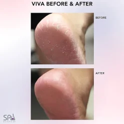Spa Sciences Viva Advanced Pedicure Foot Smoothing System Callus Remover